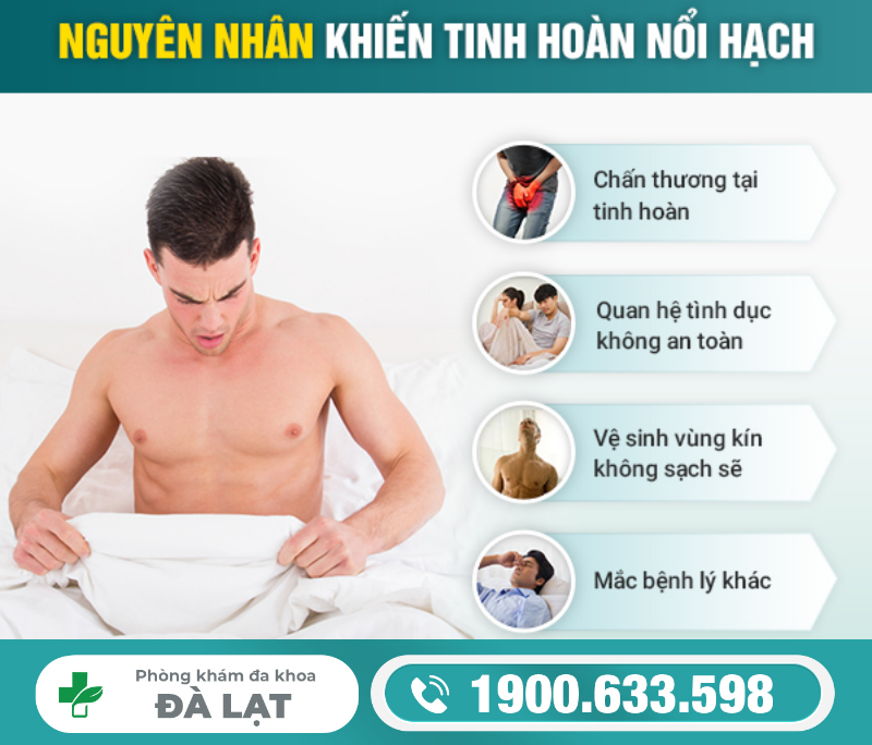 Hình ảnh minh họa